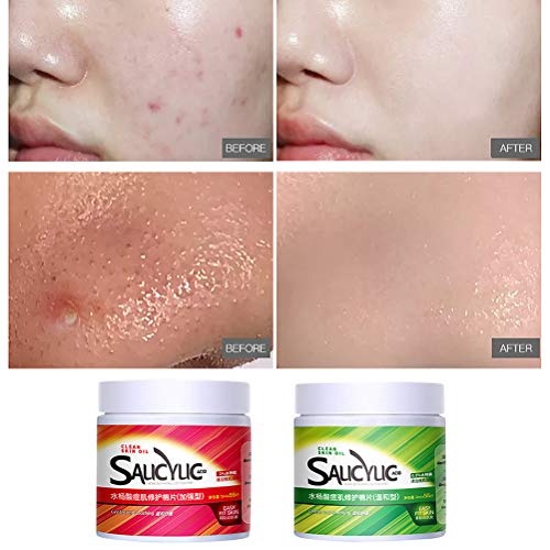 Katyma Parches faciales Almohadillas faciales Almohadilla de algodón con ácido salicílico Almohadilla de Limpieza Facial para prevenir los brotes y minimizar los poros