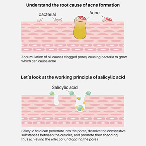 Katyma Parches faciales Almohadillas faciales Almohadilla de algodón con ácido salicílico Almohadilla de Limpieza Facial para prevenir los brotes y minimizar los poros