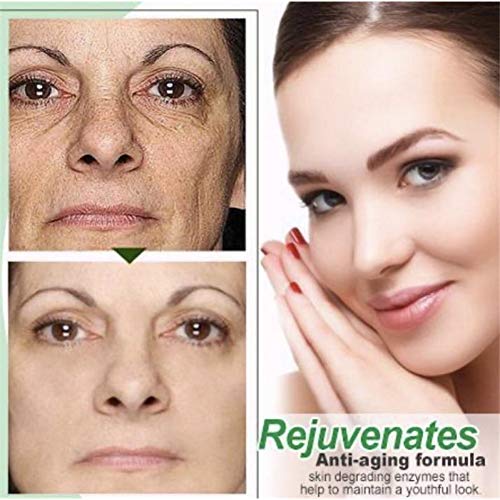 KJFUN Suero Zero Pore Instant Perfection con Ácido Lactobiónico, Solución Facial, Suero Minimizador De Poros, Removedor De Arrugas, Esencia Reafirmante