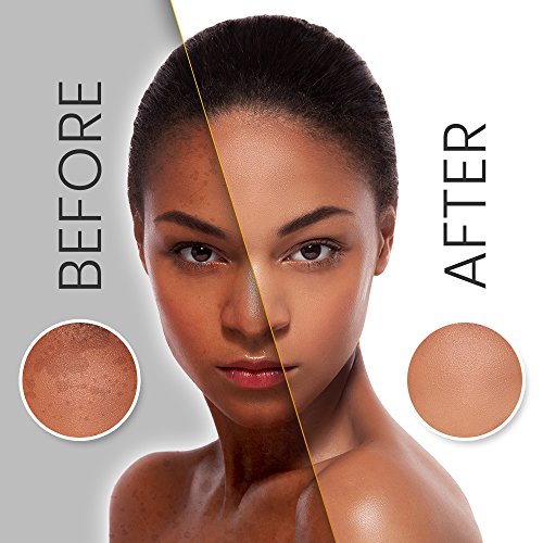 Makari Classic Skin Repair Serum Clarificante 1.35 fl.oz - Tratamiento rejuvenecedor que tonifica la piel para rostro y cuerpo - Dirigido y Reparaciones marcas oscuras y hiperpigmentación