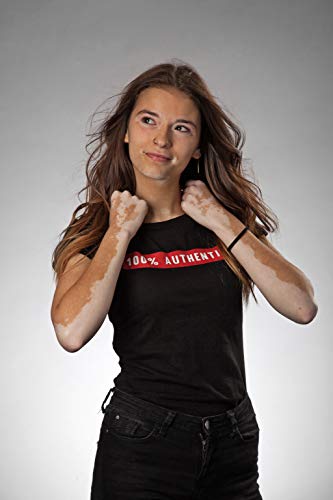 Maquillaje para las Manchas Blancas TANVITIL Spray Medio| 120 ml | Spray Corrector Tonalizador Para Camuflar la Despigmentación en Manchas Corporales Grandes e Irregulares