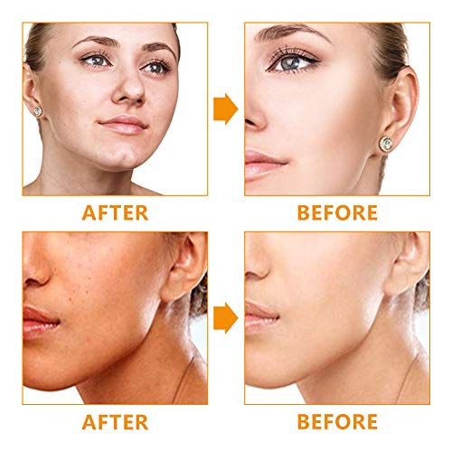 Mascarilla Iluminadora,Mascarilla Purificante,Mascarilla Blanqueadora,Mascarilla Exfoliante,Limpieza profunda de los poros de la piel, hidrata, recupera el acné espinillas, purifica e ilumina la piel