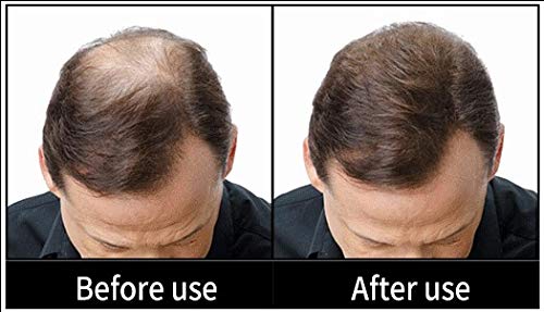 MAXX PRO-SERIES Volumizing Fibras del cabello con queratina real para adelgazar el cabello/Pérdida del cabello - 60 días + suministro - Probado por dermatólogos - Hipoalergénico - (Negro)