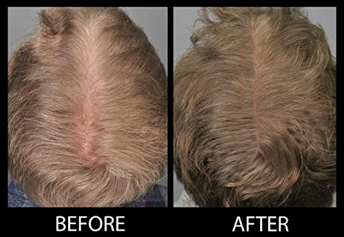 MAXX PRO-SERIES Volumizing Fibras del cabello con queratina real para adelgazar el cabello/Pérdida del cabello - 60 días + suministro - Probado por dermatólogos - Hipoalergénico - (Negro)