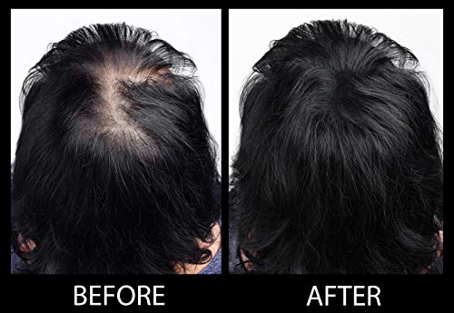 MAXX PRO-SERIES Volumizing Fibras del cabello con queratina real para adelgazar el cabello/Pérdida del cabello - 60 días + suministro - Probado por dermatólogos - Hipoalergénico - (Negro)
