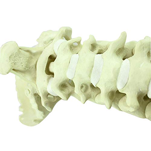 Modelo de Columna Cervical Humana, 2 Partes, Incluyendo Hueso Cortical Duro y Hueso Esponjoso Blando (Hueso Esponjoso)
