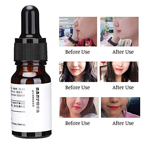 Nariz Vertical Aceite esencial Remodelación del hueso nasal Aceite esencial Magia Nariz Levantamiento Levantador Formador