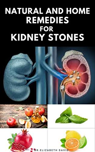 NATURAL AND HOME REMEDIES FOR KIDNEY STONES : Herbal And Home Remedies For Preventing ,Dissolving And Healing Kidney Stone (English Edition)