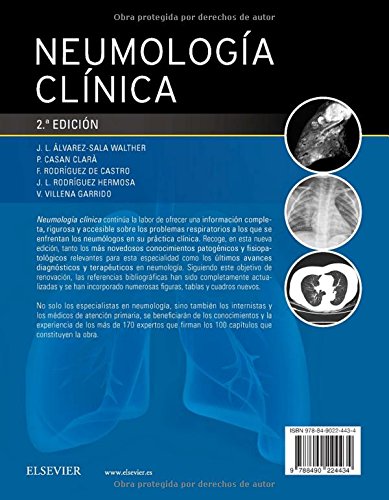 Neumología clínica - 2ª edición