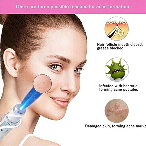 New Blue Light Therapy Varicose Veins Pen - Soft Scar Acne Wrinkle Removal, Improve Skin Elasticity