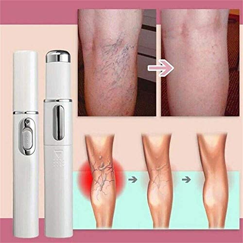 New Blue Light Therapy Varicose Veins Pen - Soft Scar Acne Wrinkle Removal, Improve Skin Elasticity
