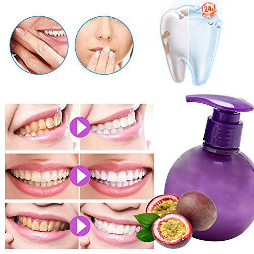 Pasta Dientes Blanqueadora,Whitening Toothpaste,Dental Blanqueadora,Pasta de Dientes con Bicarbonato de Sodio, Lucha Contra el Sangrado de Las Encías, Quitamanchas de Dientes