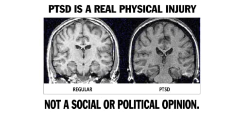 Relief From PTSD