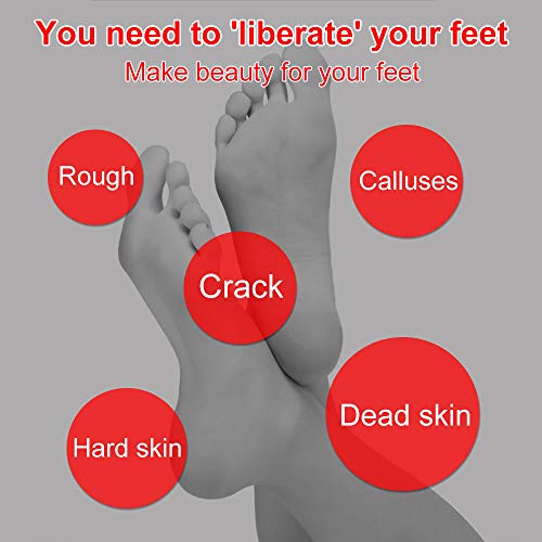 RMENOOR Cortacallos de Acero Inoxidable - Rascador de Callos profesional/Cuchillo de pedicura de manicura para cuidados de pedicura Pedicure de callos de maíz Removedor de Durezas