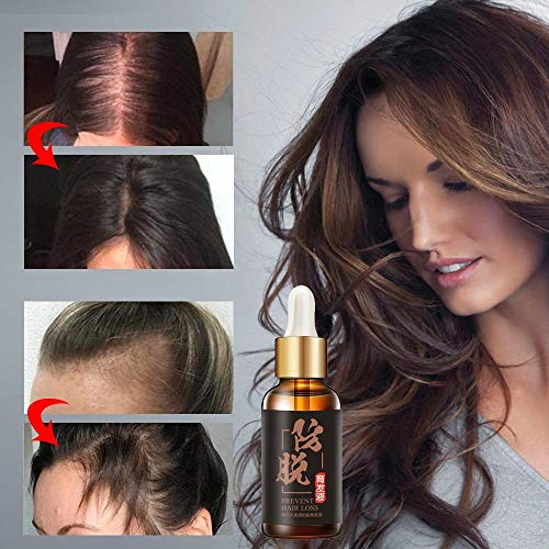 Tratamiento de Crecimiento rápido del Cabello Aceite Esencial para el Cabello - Pack: spray-yfy022