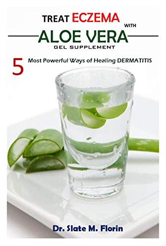 Treat Eczema With Aloe Vera Gel Supplement: 5 most powerful ways of Healing Dermatitis (English Edition)