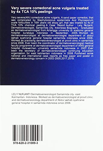 Very severe comedonal acne vulgaris treated by 4x TCA 10% peelings: A sand paper comedos, complicated by folliculities in 16th atopy girl, treated with 4x of TCA 10% peelings