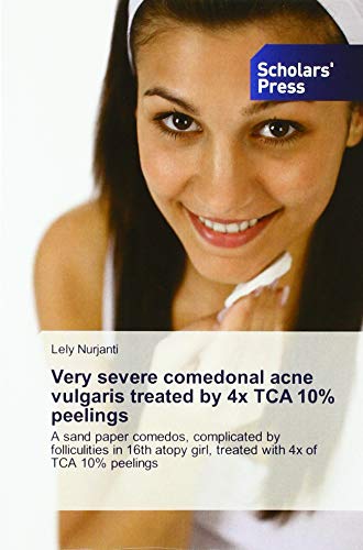 Very severe comedonal acne vulgaris treated by 4x TCA 10% peelings: A sand paper comedos, complicated by folliculities in 16th atopy girl, treated with 4x of TCA 10% peelings