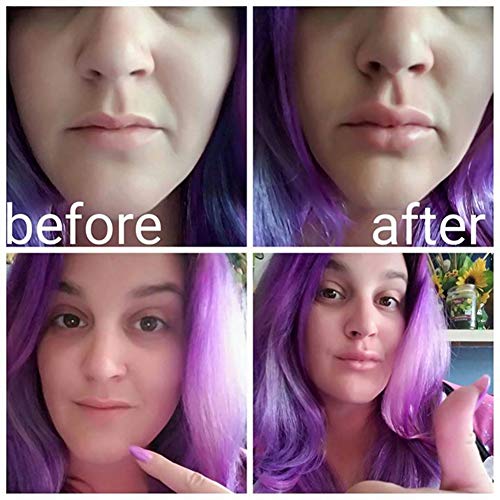 WOGQX 3 Piezas De Relleno De Labios, Dispositivo De Silicona para Rellenar Los Labios, Potencia De Succión, Herramientas para Agrandar Los Labios De La Boca, para Mujeres, Halloween