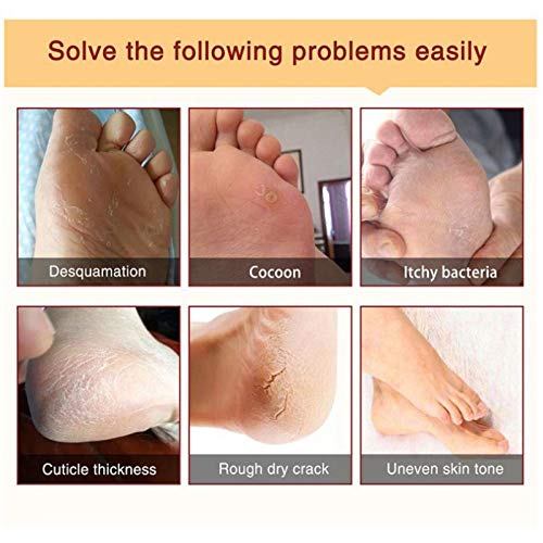 yotijar Baby Soft Foot Peeling Mascarilla Calcetines Callos Exfoliantes Piel - Árbol del té