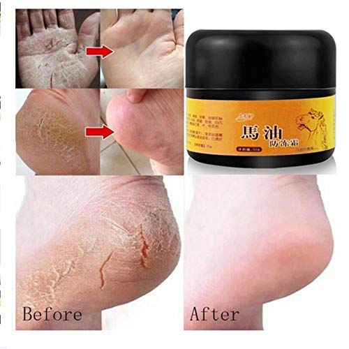 30 g de aceite anticongelante para caballos, crema antipicor, crema anticongelante contra picores, lociones