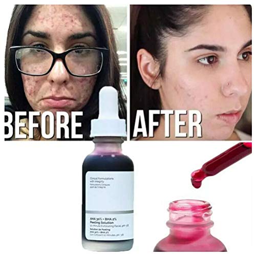 30Ml Aha 30% + Bha 2% Peeling Solution 10-Minute Exfoliating Face Brighten Serum Face Cuidado de la Piel Limpieza de poros Brillo Facial Antienvejecimiento