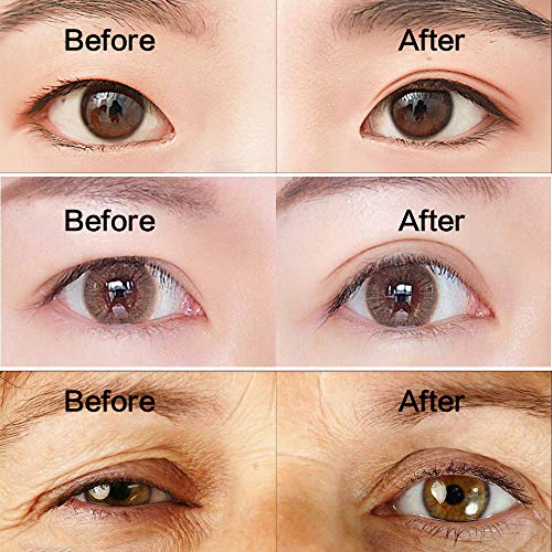 550 Pares Cinta de Párpados Invisibles, Pegatinas de Doble Párpados de Instante Levantar, Perfecto Para Párpado Caído, Desigual o Mono-Eyelids (Forma Ancha + Forma Oliva)