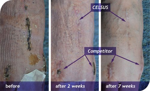 CELSUS Bio-Intelligence Scar Cream with Peptides, 0.7 Ounce by Celsus Bio-Intelligence