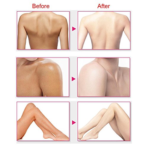 Crema para el cuerpo, Crema corporal blanqueadora Crema hidratante para el cuerpo Loción corporal Crema para el cuidado de la piel