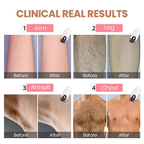 Delanie Depiladora de Luz Pulsada Electrica Mujer IPL Permanente e Indolora Profesional para Mujer y Hombres con 2 Modos de Flashesy Pantalla LCD para Cuerpo en Casa