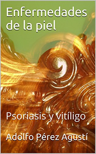 Enfermedades de la piel: Psoriasis y vitíligo (Tratamiento natural nº 43)