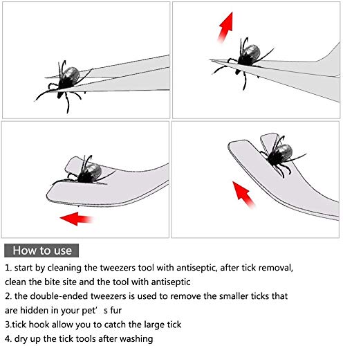 JIASHA Herramientas de Kit para Quitar Garrapatas Kit de Pinzas de Garrapatas de Acero Inoxidable en Caja de Almacenamiento ，para Perro/Gato/Hombre