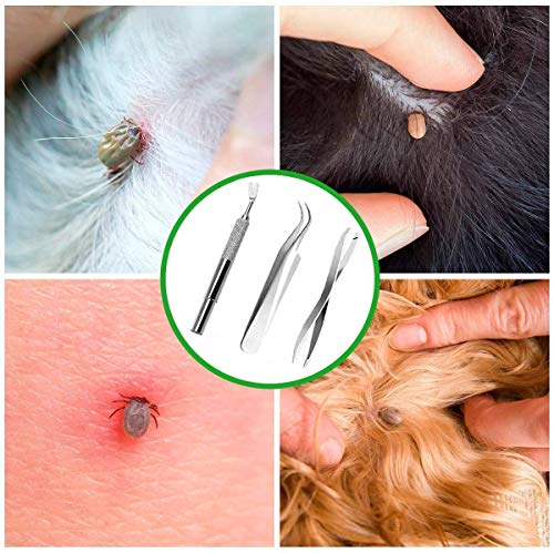 JIASHA Herramientas de Kit para Quitar Garrapatas Kit de Pinzas de Garrapatas de Acero Inoxidable en Caja de Almacenamiento ，para Perro/Gato/Hombre