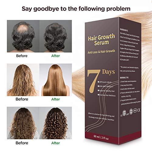 JIM'S STORE Sérum de Crecimiento del Cabello,Aceite para Crecimiento del Cabello Acelerar el Crecimiento del Cabello Estimula el Crecimiento Cabello para Hombres y Mujeres（60ML）