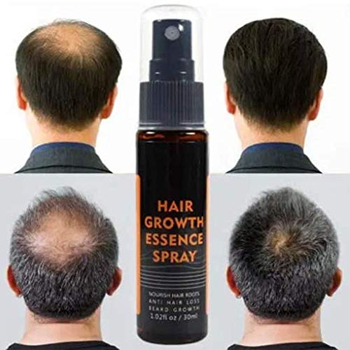 KEENCOOL Hair Regrowth Essence Intensive Spray,Suero De Crecimiento Capilar,Anti Hair Loss Nourish Hair Roots Repara Los Folículos