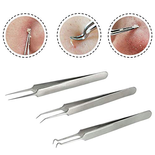 Kit removedor de puntos negros con 10 espejos, pinzas profesionales para acné y acné para quitar puntos blancos, espinillas