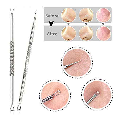 Kit removedor de puntos negros con 10 espejos, pinzas profesionales para acné y acné para quitar puntos blancos, espinillas