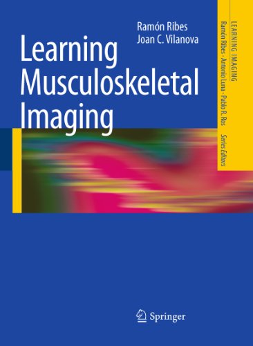Learning Musculoskeletal Imaging (Learning Imaging) (English Edition)