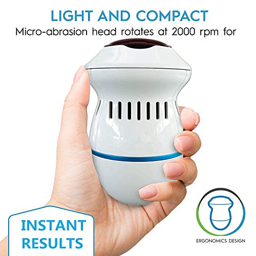 Lima Electrónica para Durezas Pies, elimina fácilmente callos y piel, Electrica Pedicura Pies Vac utiliza un vacío incorporado.