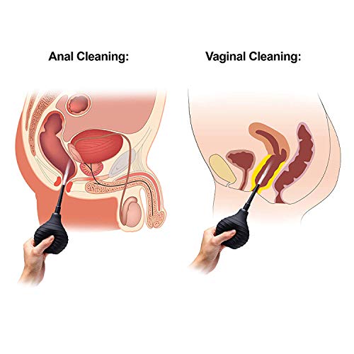 Meiruier 225ml Anal enema medico Silicone y anal lavado Anti-reflux Enema vaginal Syringe shower Ayuda con el estreñimiento