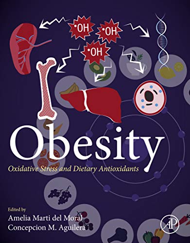 Obesity: Oxidative Stress and Dietary Antioxidants (English Edition)