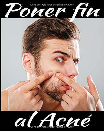 Poner fin al acné: Controla tu acné día tras día, con seguimiento de los síntomas, la dieta, los tratamientos, la intensidad del dolor, etc... 8X10, 101 páginas