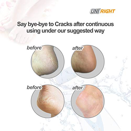 UNI RIGHT Electric Foot File, Pedicure Feet Care Machine with 2 Rollers, Dead Skin Removal,Hard Foot Skin Smooth Exfoliating for Foot Spa/Rechargeable Pedicure Hard Skin Remover (Blue)