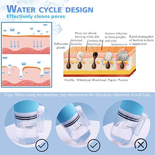 VIVILIAN Espinilla Aspiradora Limpiador Espinilla Extractor Recargable Poro Limpiador Portátil Burbuja Facial Limpiador con 4 Sondas y 3 Modos