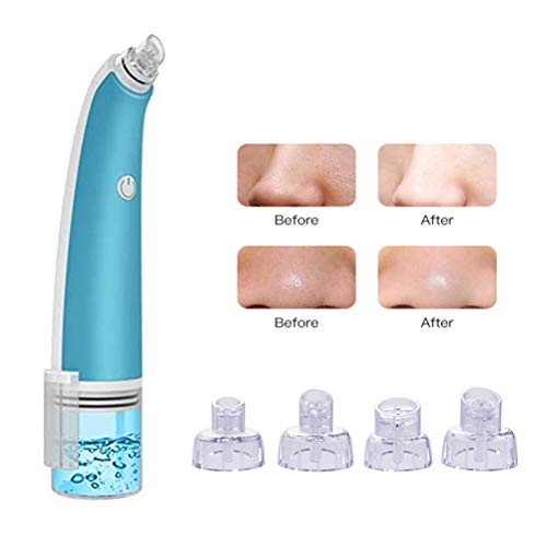 VIVILIAN Espinilla Aspiradora Limpiador Espinilla Extractor Recargable Poro Limpiador Portátil Burbuja Facial Limpiador con 4 Sondas y 3 Modos