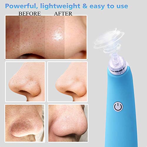 VIVILIAN Espinilla Aspiradora Limpiador Espinilla Extractor Recargable Poro Limpiador Portátil Burbuja Facial Limpiador con 4 Sondas y 3 Modos