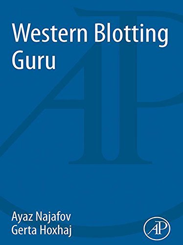 Western Blotting Guru (English Edition)