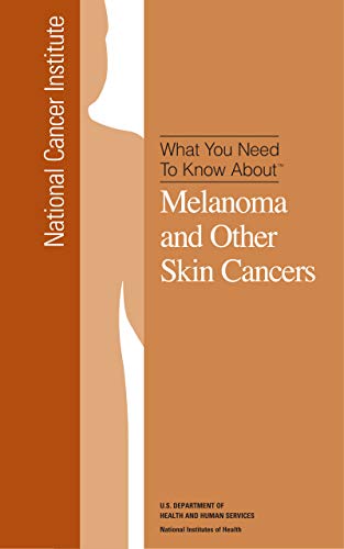What You Need To Know About TM Melanoma and Other Skin Cancers (English Edition)