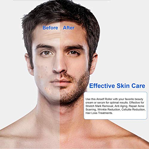 Anself Kit de Cuidado de la Barba para Hombres Kit para el Cuidado del Bigote Arrugas Faciales Kit de la Marca de Estiramiento para la Pérdida de Crecimiento del Cabello Regalos para Hombres