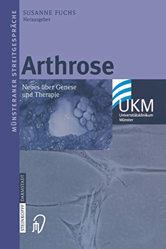Arthrose: Neues über Genese und Therapie (Münsteraner Streitgespräche)